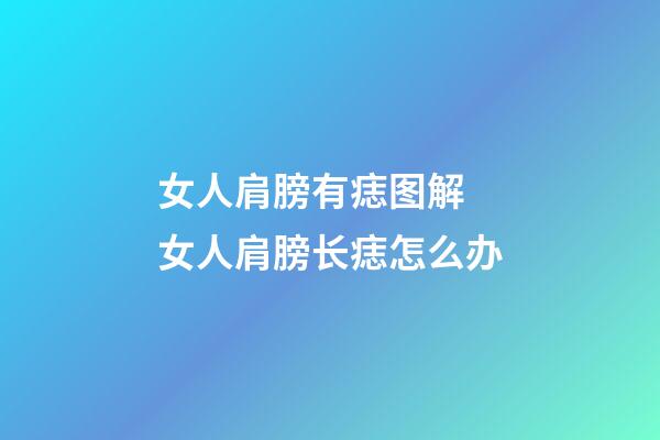 女人肩膀有痣图解 女人肩膀长痣怎么办